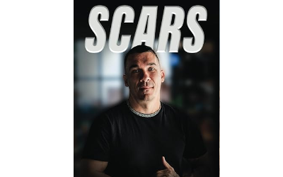 71. Scars l Troy Fontana