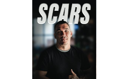 Scars: Secrets to Master Your Mind and Turn Your Pain Trauma and Loss into a Superpower